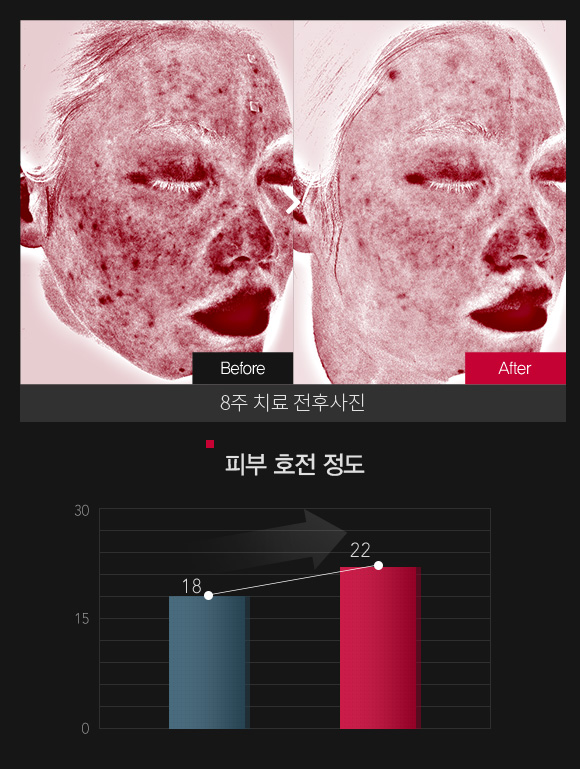 붉은기 & 피부 민감도 호전정도