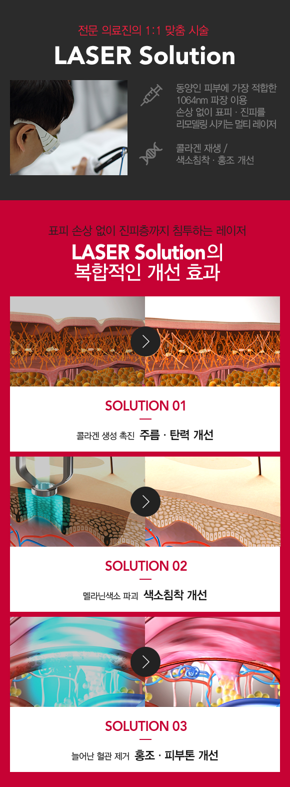 복합 레이저