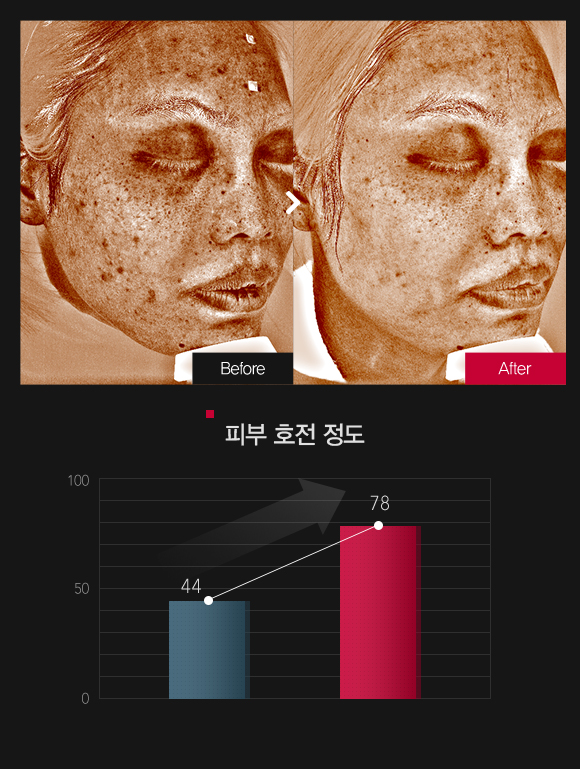 잡티 & 반점 호전정도