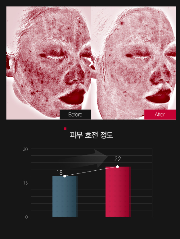 붉은기 & 민감도 호전정도