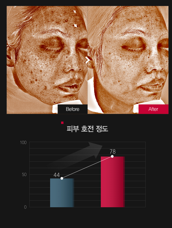 피부 변색 & 피부 속 색소침착 호전정도